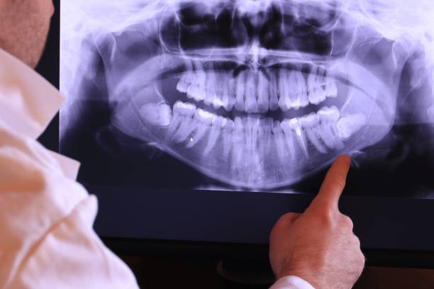 Best Emergency Care for Gum Disease in Hallettsville, TX